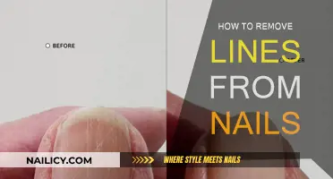 Get Rid of Nail Lines: Simple Home Remedies
