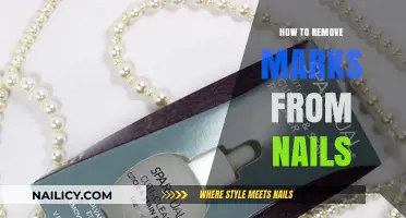 Erase Nail Marks: Simple Home Remedies