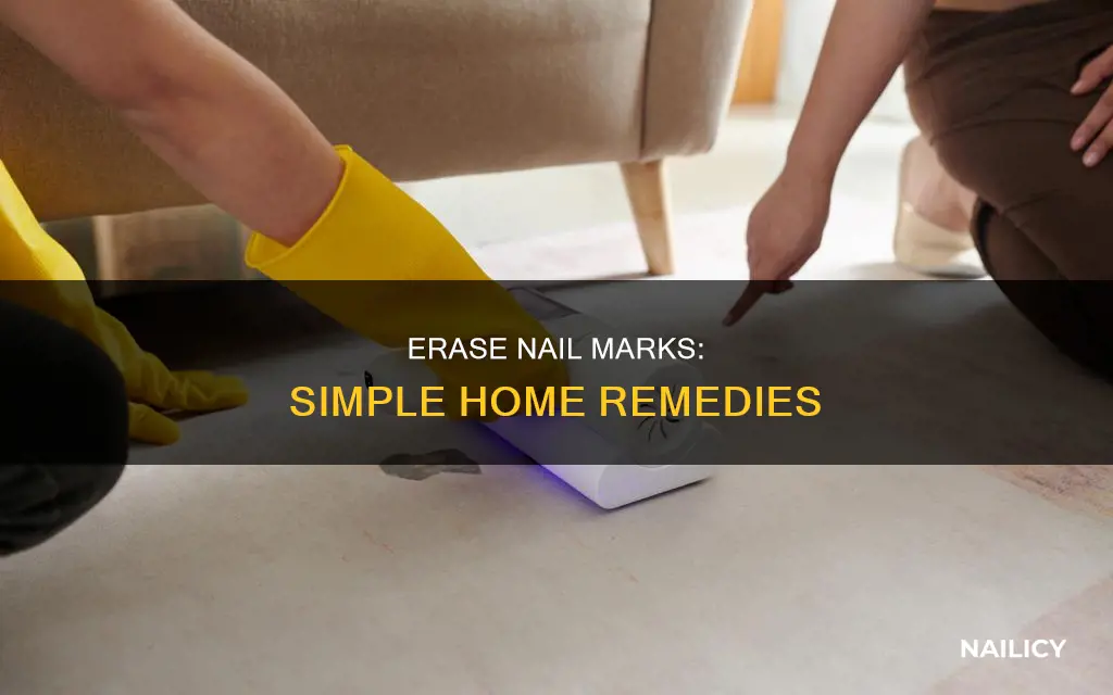 how to remove marks from nails