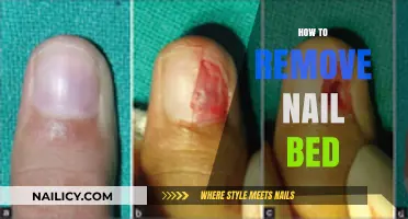 The Easy Guide to Removing Nail Beds