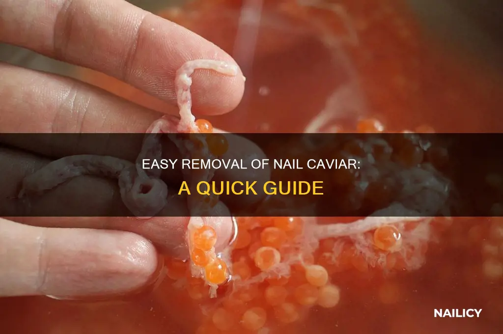 how to remove nail caviar