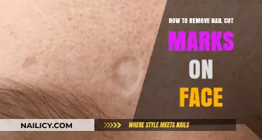 Erase Nail Cut Marks: Simple Solutions for Your Face