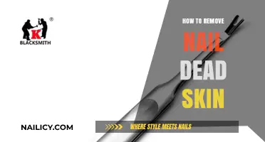 Get Rid of Nail Dead Skin at Home