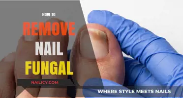 Eradicate Nail Fungal Infections: Effective Home Remedies