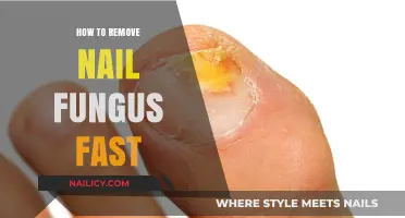 Eradicate Nail Fungus: Quick and Easy Solutions