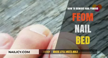 Eradicating Nail Fungus: Effective Home Remedies for Clear Nails
