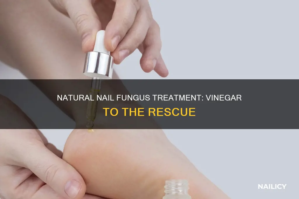 how to remove nail fungus with vinegar