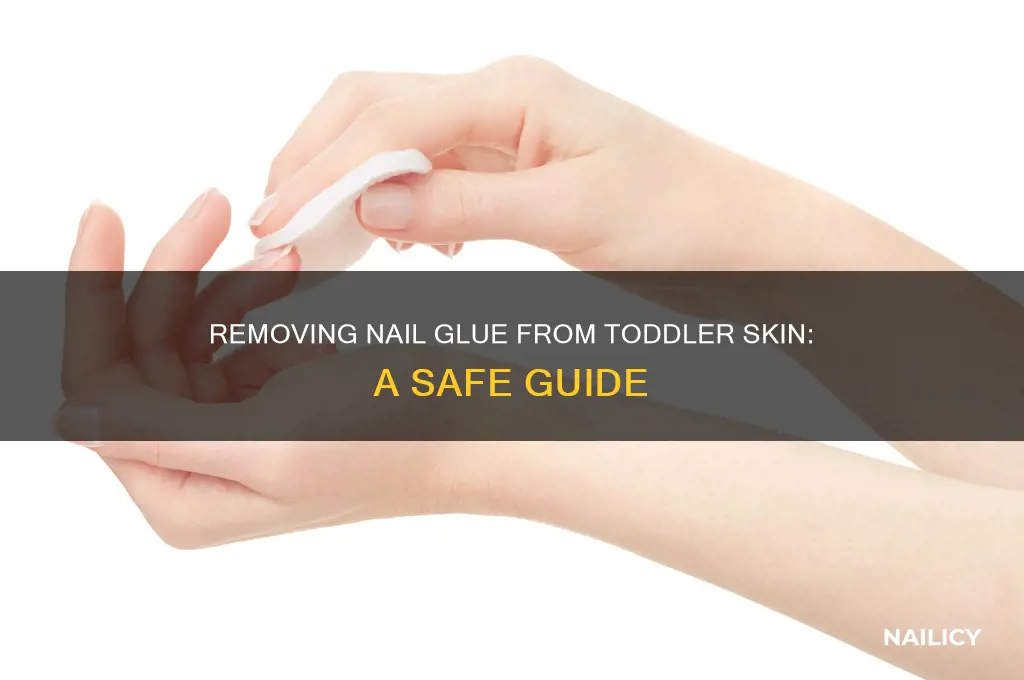 how to remove nail glue from a toddler skin