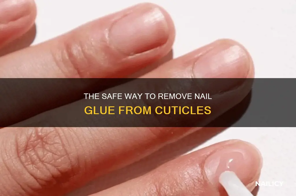 how to remove nail glue from cuticles
