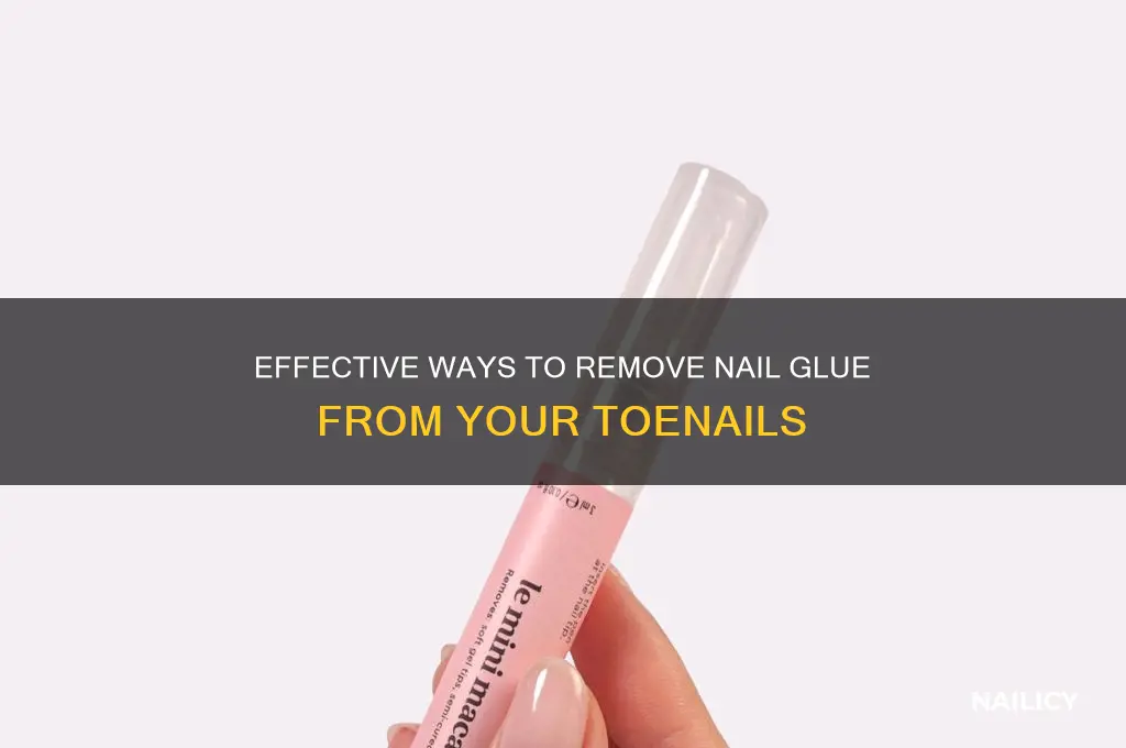 how to remove nail glue from toenails