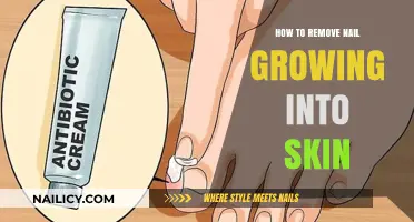 Treating Ingrown Nails: Home Remedies and Prevention Tips
