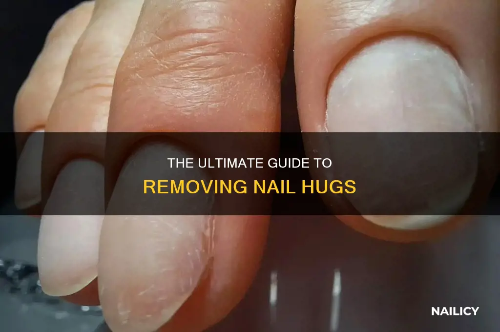 how to remove nail hugs