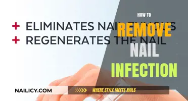 Eradicate Nail Infections: Effective Home Remedies
