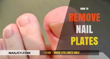 Easy Steps to Remove Nail Plates at Home