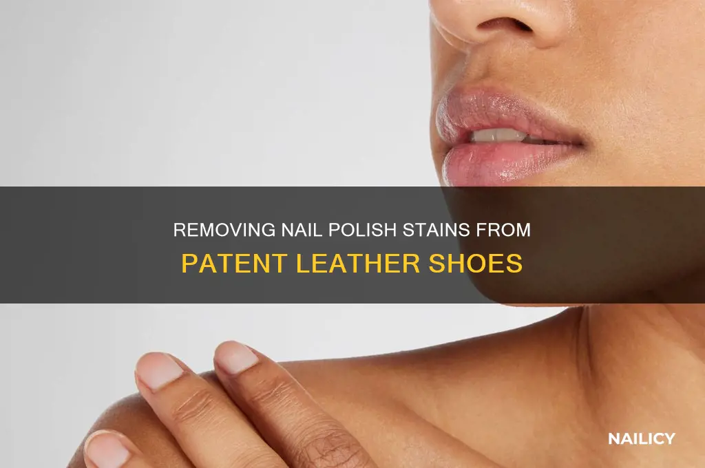 how to remove nail polish from patent leather shoes