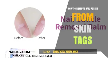 Easy Tips to Remove Nail Polish from Skin Tags