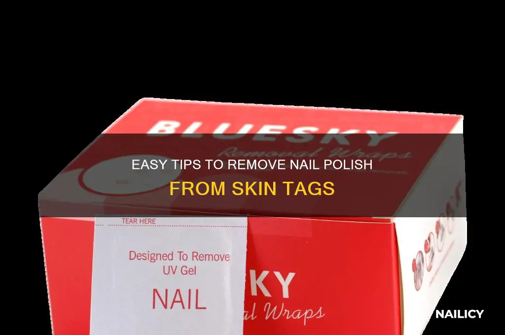 how to remove nail polish from skin tags