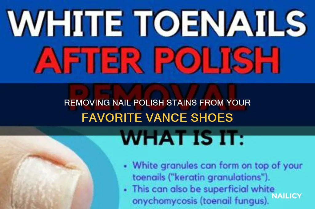 how to remove nail polish off vances shoes