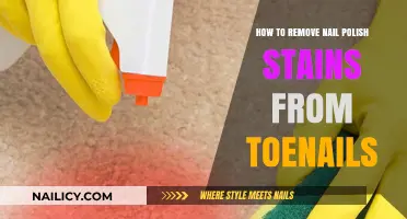 Erase Nail Polish Stains: Toenail Tips and Tricks