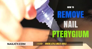 Eradicate Nail Pterygium: Effective Treatment Options