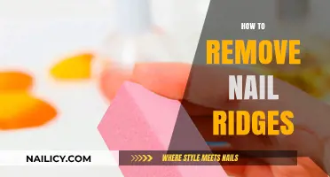 Get Rid of Nail Ridges: Effective Solutions