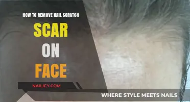 Erase Nail Scratch Scars from Your Face