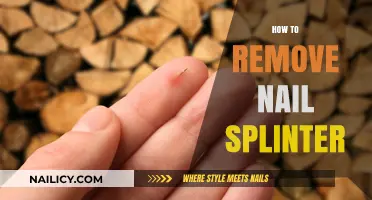 Effective Splinter Removal: Nail Care and Treatment