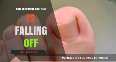Effective Home Remedies for a Falling-Off Nail