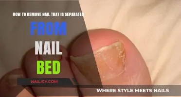Fixing a Nail Separated from the Nail Bed