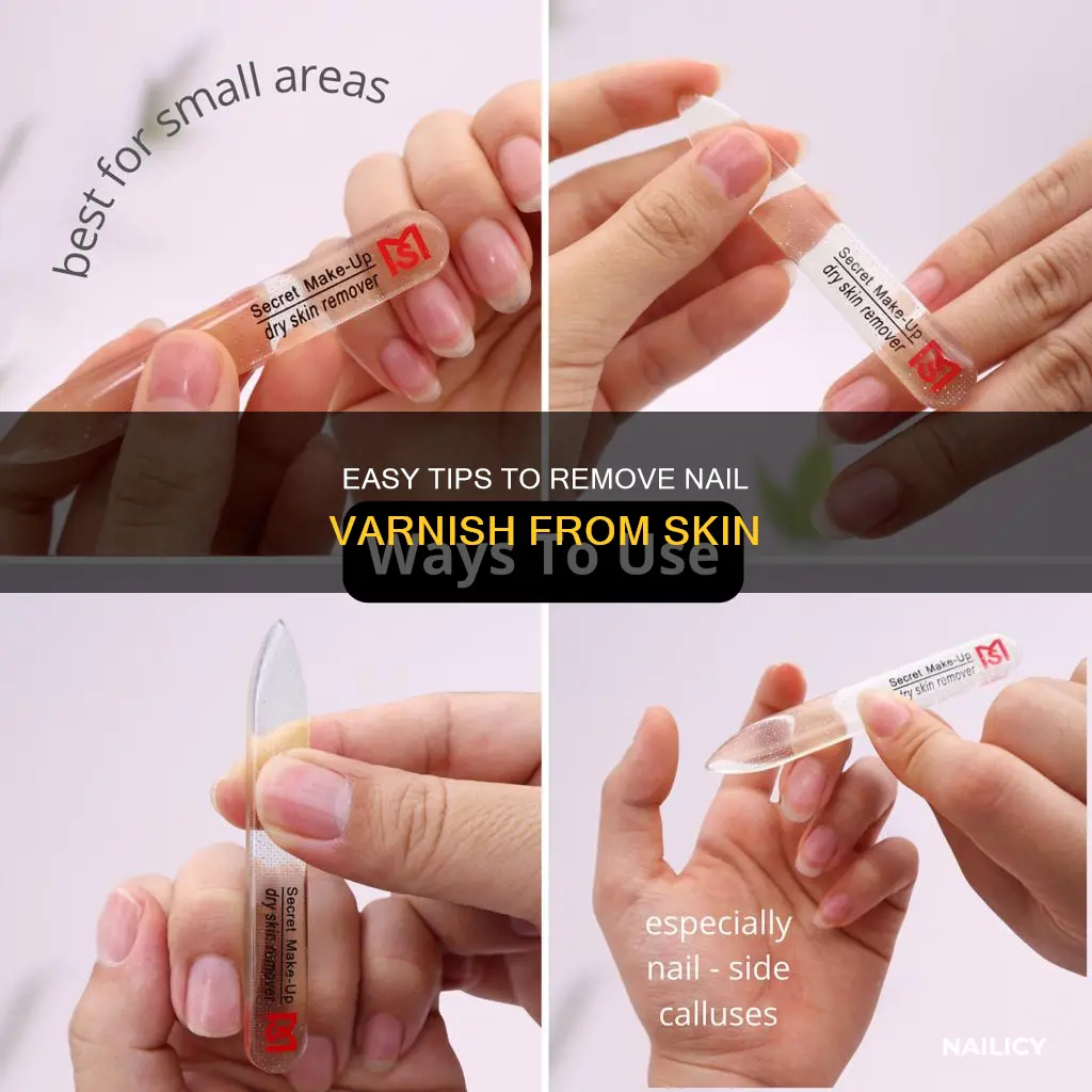 how to remove nail varnish from skin