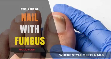 Eradicating Nail Fungus: Effective Home Remedies