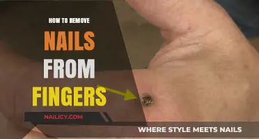 Effective Ways to Remove Nails from Fingers