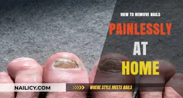 Easy, Pain-Free Nail Removal at Home