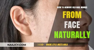 Erase Nail Marks from Your Face with Natural Remedies