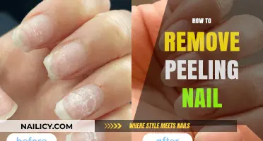 Fixing Peeling Nails: Home Remedies and Tips