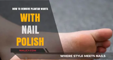 Effective Home Remedy: Nail Polish for Plantar Warts