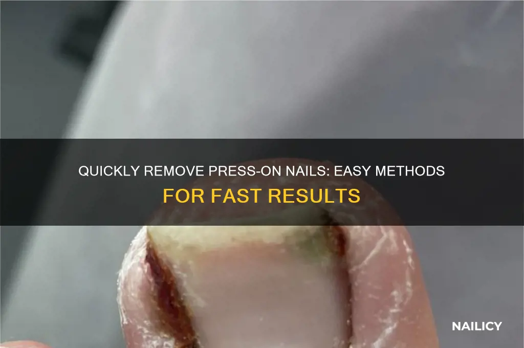 how to remove press on nails fast