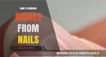 Get Rid of Nail Ridges: Effective Home Remedies