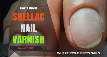 Effective Shellac Nail Varnish Removal Techniques