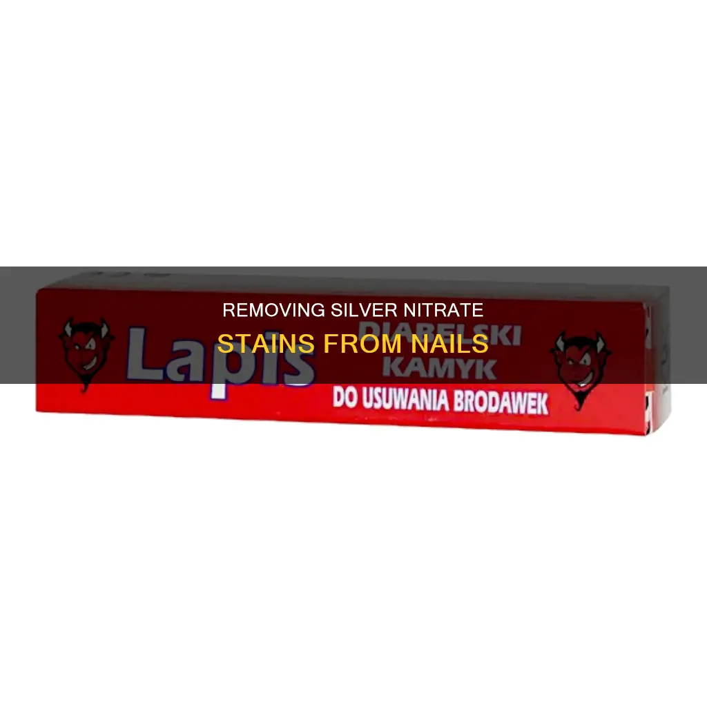 how to remove silver nitrate from nail