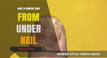 Effective Ways to Remove Skin from Under Nails