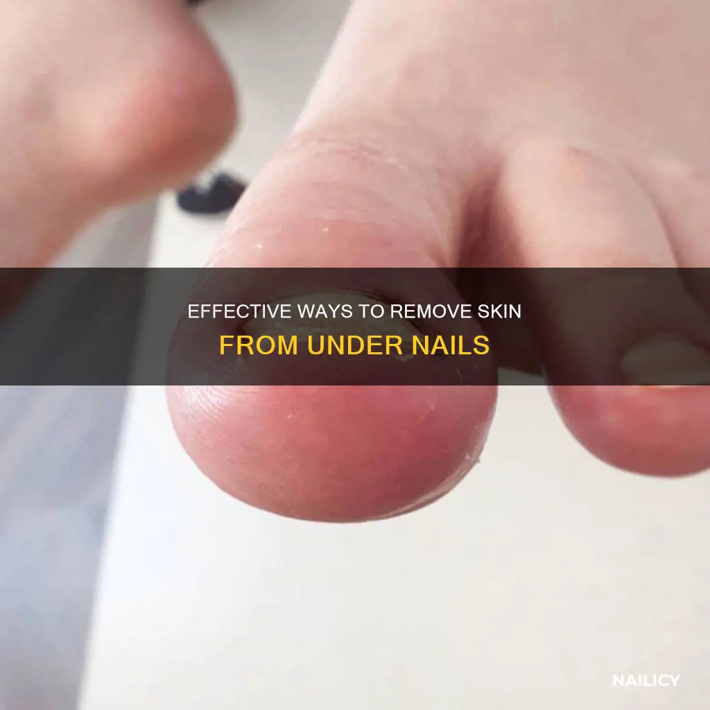 how to remove skin from under nail
