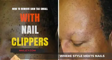 Easy Skin Tag Removal: Clippers for Small Tags