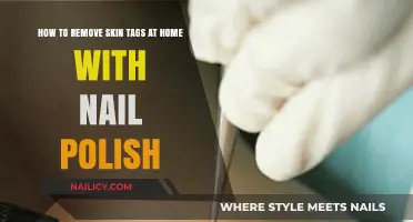 Effective Home Remedy: Nail Polish for Skin Tags