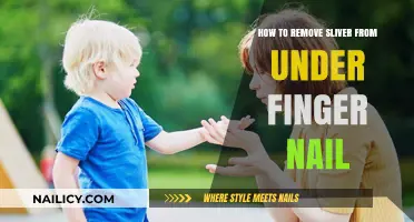 Efficiently Removing Slivers from Under Fingernails