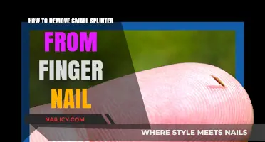 Easy Splinter Removal: Fingernail Safety