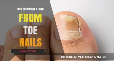 Effective Methods to Remove Stubborn Toe Nail Stains