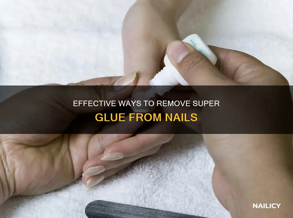 how to remove superglue from nail