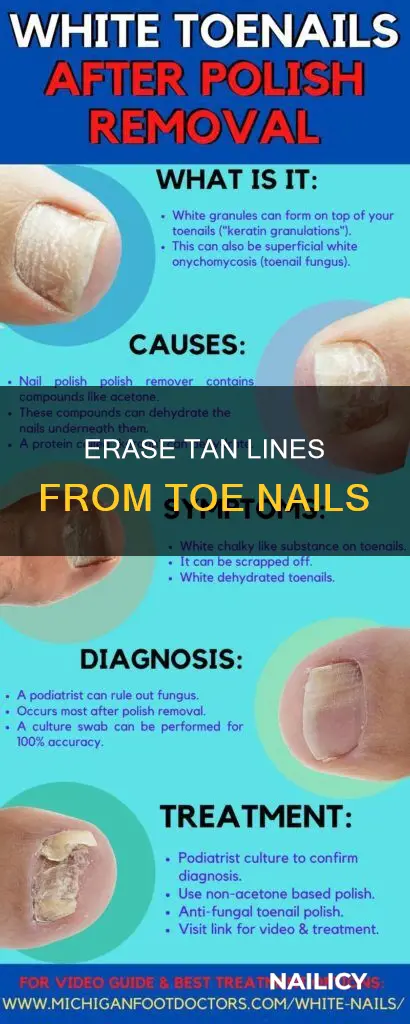 how to remove tan from toe nails