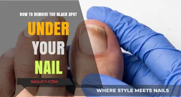 Get Rid of Black Spots Under Nails